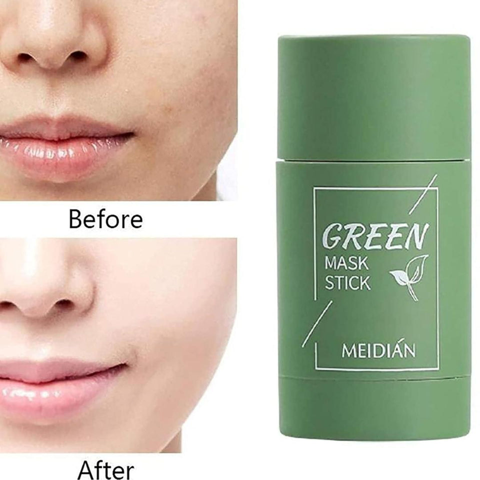 Green Mask Stick – Blackhead Remover & Acne Treatment | 100% Natural Skincare